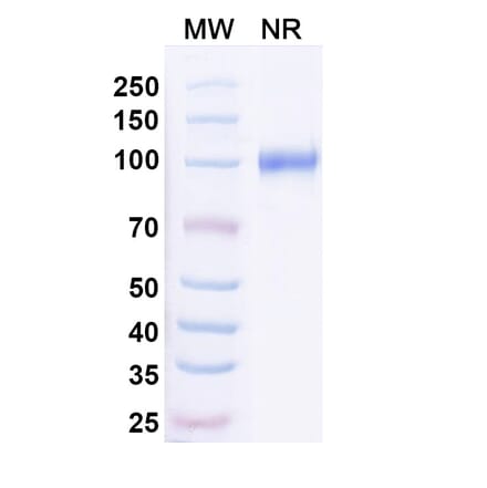SDS-PAGE - Anti-Neisseria Adhesin A Nanobody [G9] (A338227) - Antibodies.com