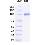 SDS-PAGE - Anti-Neisseria Adhesin A Nanobody [G9] (A338227) - Antibodies.com