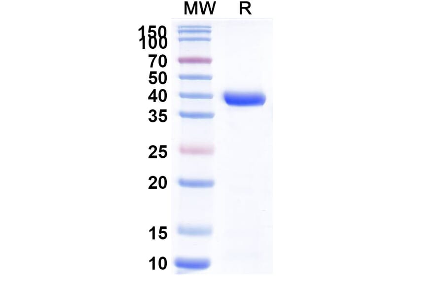 SDS-PAGE - Anti-Neisseria Adhesin A Nanobody [F3] (A338228) - Antibodies.com