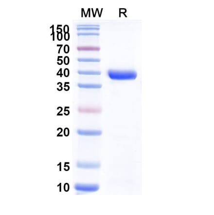 SDS-PAGE - Anti-Neisseria Adhesin A Nanobody [F3] (A338228) - Antibodies.com