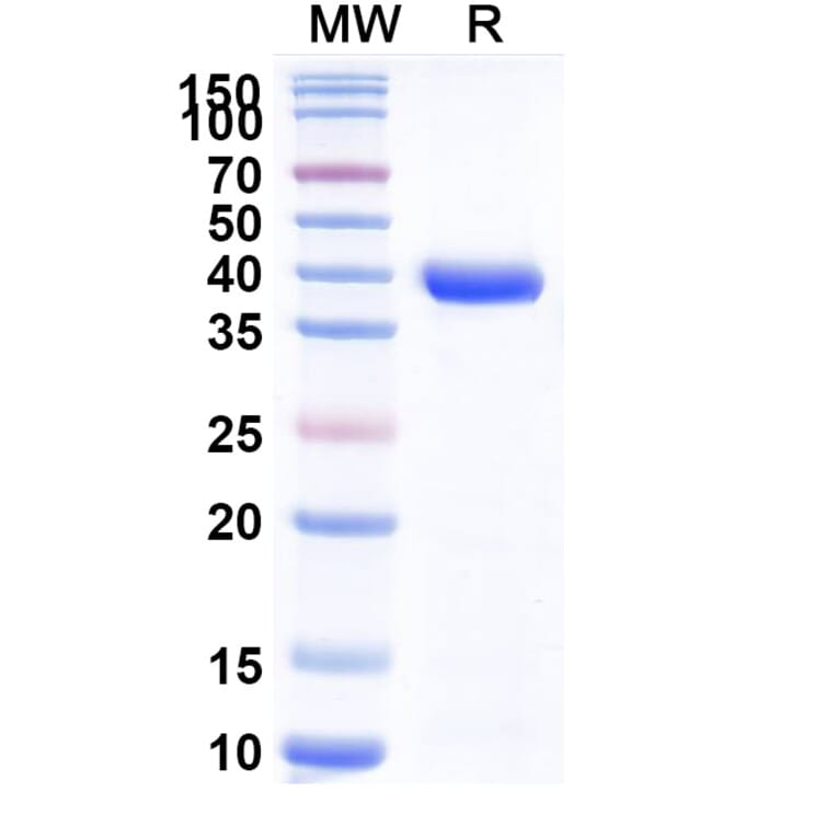 SDS-PAGE - Anti-Neisseria Adhesin A Nanobody [F3] (A338228) - Antibodies.com