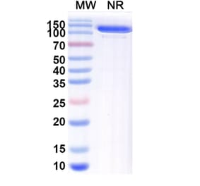 SDS-PAGE - Anti-blm Nanobody [SAA1991] (A338229) - Antibodies.com