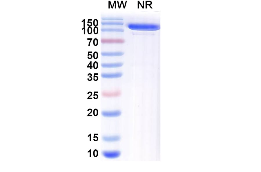 SDS-PAGE - Anti-blm Nanobody [SAA1991] (A338229) - Antibodies.com