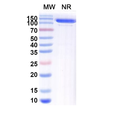 SDS-PAGE - Anti-blm Nanobody [SAA1991] (A338229) - Antibodies.com