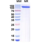 SDS-PAGE - Anti-blm Nanobody [SAA1991] (A338229) - Antibodies.com