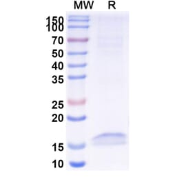SDS-PAGE - Anti-Cannabinoid Receptor I Nanobody [5D12] (A338230) - Antibodies.com
