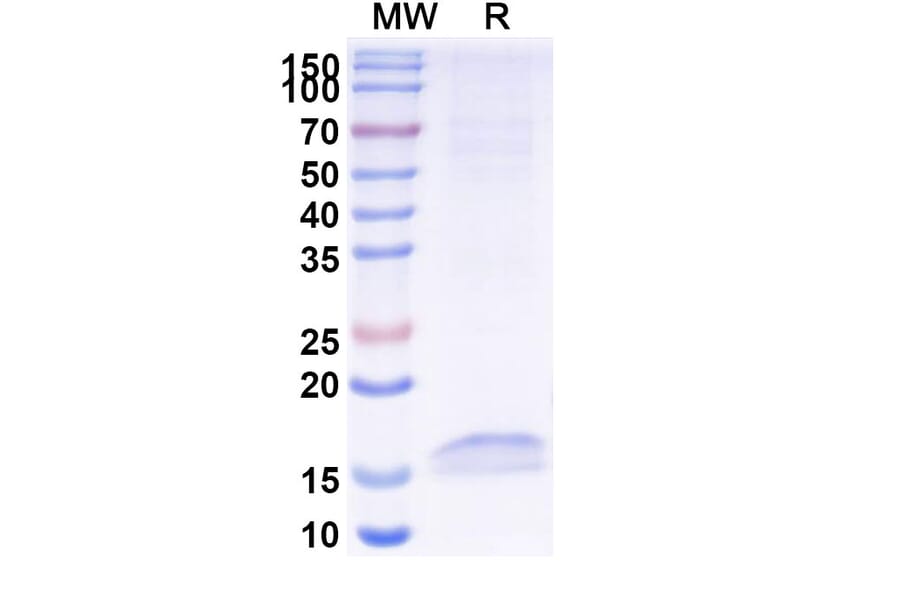 SDS-PAGE - Anti-Cannabinoid Receptor I Nanobody [5D12] (A338230) - Antibodies.com