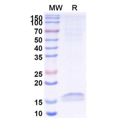 SDS-PAGE - Anti-Cannabinoid Receptor I Nanobody [5D12] (A338230) - Antibodies.com