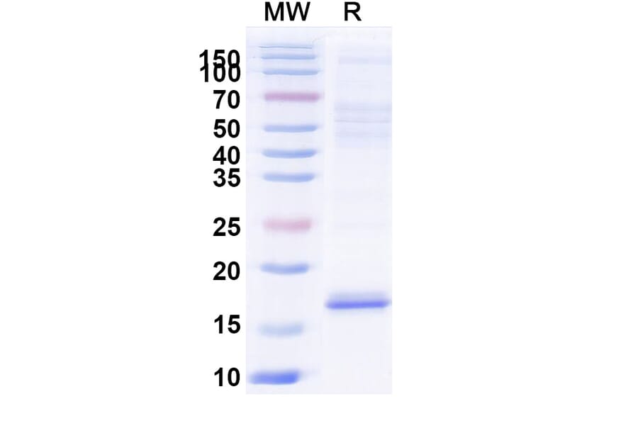 SDS-PAGE - Anti-Cannabinoid Receptor I Nanobody [5D12] (A338230) - Antibodies.com
