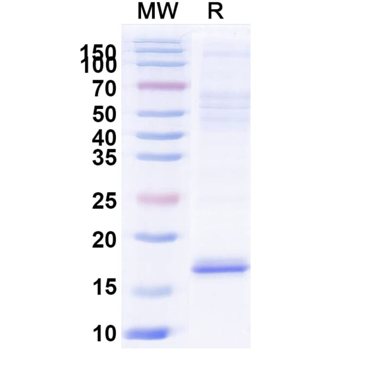 SDS-PAGE - Anti-Cannabinoid Receptor I Nanobody [5D12] (A338230) - Antibodies.com