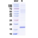 SDS-PAGE - Anti-Cannabinoid Receptor I Nanobody [5D12] (A338230) - Antibodies.com