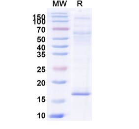 SDS-PAGE - Anti-Cannabinoid Receptor I Nanobody [5G11] (A338231) - Antibodies.com
