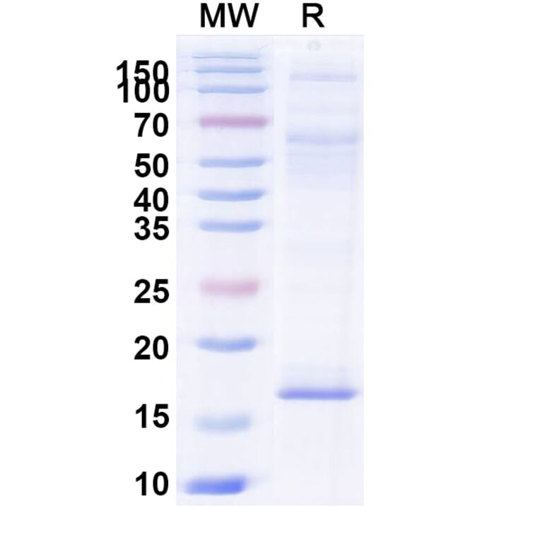 SDS-PAGE - Anti-Cannabinoid Receptor I Nanobody [5G11] (A338231) - Antibodies.com