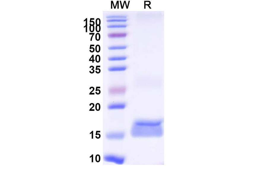 SDS-PAGE - Anti-Cannabinoid Receptor I Nanobody [6B7] (A338232) - Antibodies.com