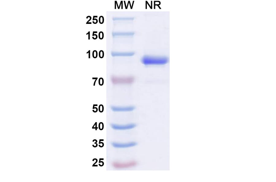 SDS-PAGE - Anti-DR5 Nanobody [SAA2021] (A338236) - Antibodies.com