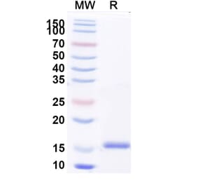 SDS-PAGE - Anti-Factor H Nanobody [SAA2038] (A338254) - Antibodies.com