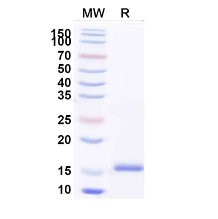 SDS-PAGE - Anti-Factor H Nanobody [SAA2038] (A338254) - Antibodies.com