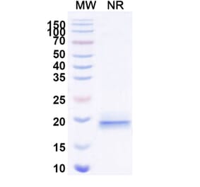 SDS-PAGE - Anti-DLL3 Nanobody [SAA2046] (A338255) - Antibodies.com