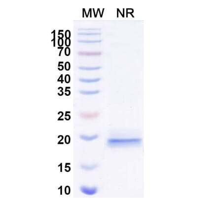 SDS-PAGE - Anti-DLL3 Nanobody [SAA2046] (A338255) - Antibodies.com