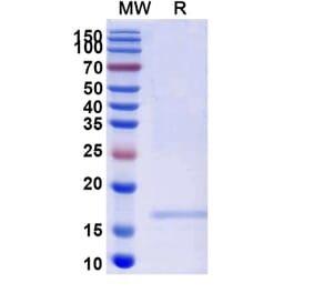 SDS-PAGE - Anti-FGFR2 Nanobody [SAA2047] (A338256) - Antibodies.com