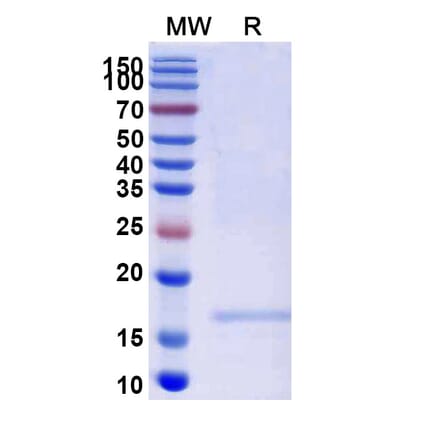 SDS-PAGE - Anti-FGFR2 Nanobody [SAA2047] (A338256) - Antibodies.com