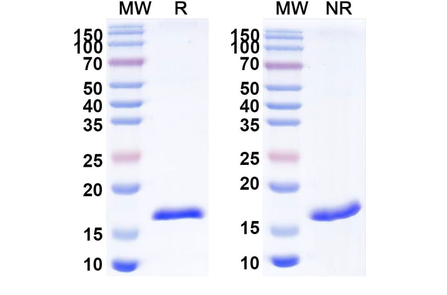 SDS-PAGE - Anti-CD70 Nanobody [SAA2049] (A338258) - Antibodies.com