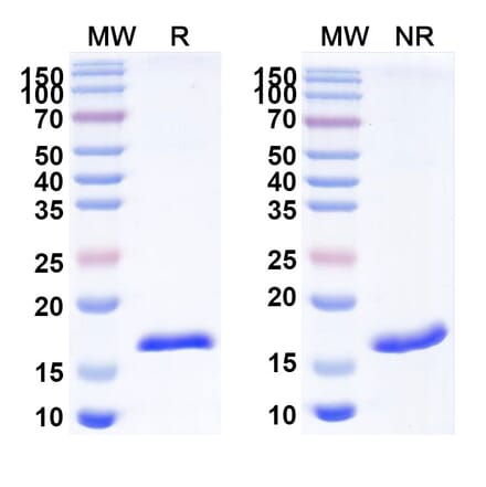 SDS-PAGE - Anti-CD70 Nanobody [SAA2049] (A338258) - Antibodies.com