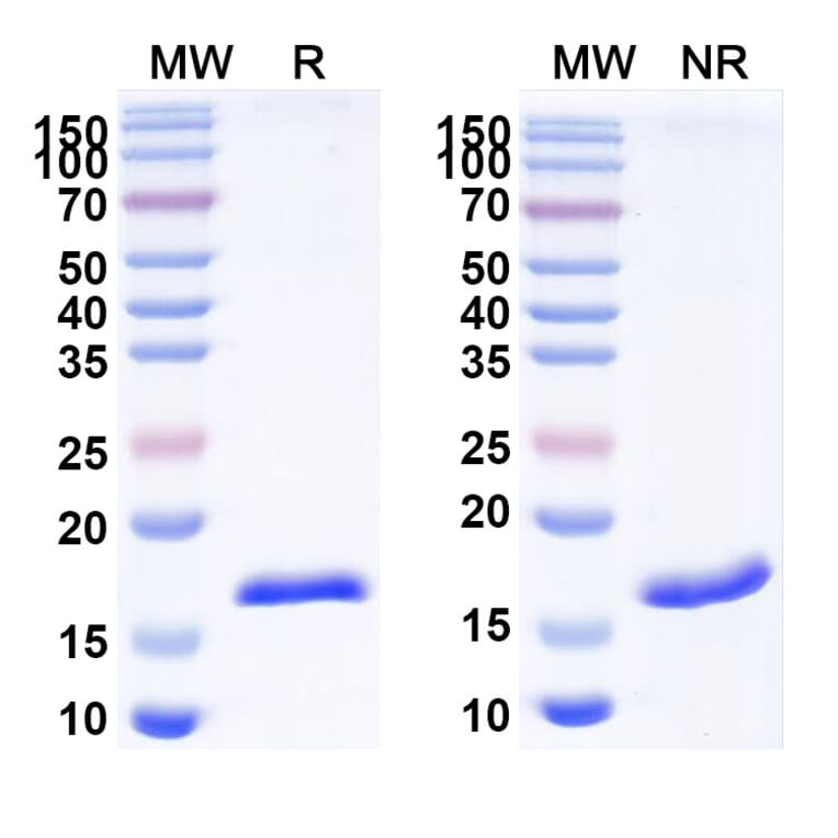 SDS-PAGE - Anti-CD70 Nanobody [SAA2049] (A338258) - Antibodies.com