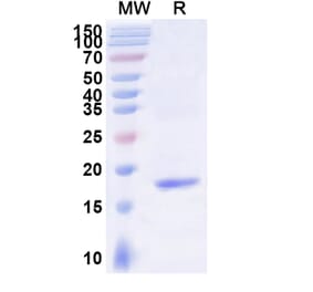 SDS-PAGE - Anti-Mesothelin Nanobody [SAA2050] (A338259) - Antibodies.com