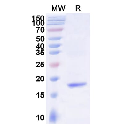 SDS-PAGE - Anti-Mesothelin Nanobody [SAA2050] (A338259) - Antibodies.com
