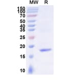 SDS-PAGE - Anti-Mesothelin Nanobody [SAA2050] (A338259) - Antibodies.com