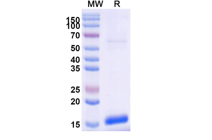 SDS-PAGE - Anti-TNFRSF13C Nanobody [SAA2053] (A338262) - Antibodies.com