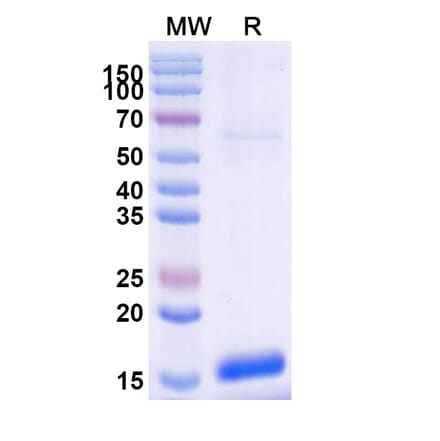 SDS-PAGE - Anti-TNFRSF13C Nanobody [SAA2053] (A338262) - Antibodies.com