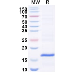 SDS-PAGE - Anti-VWF Nanobody [C37] (A338270) - Antibodies.com