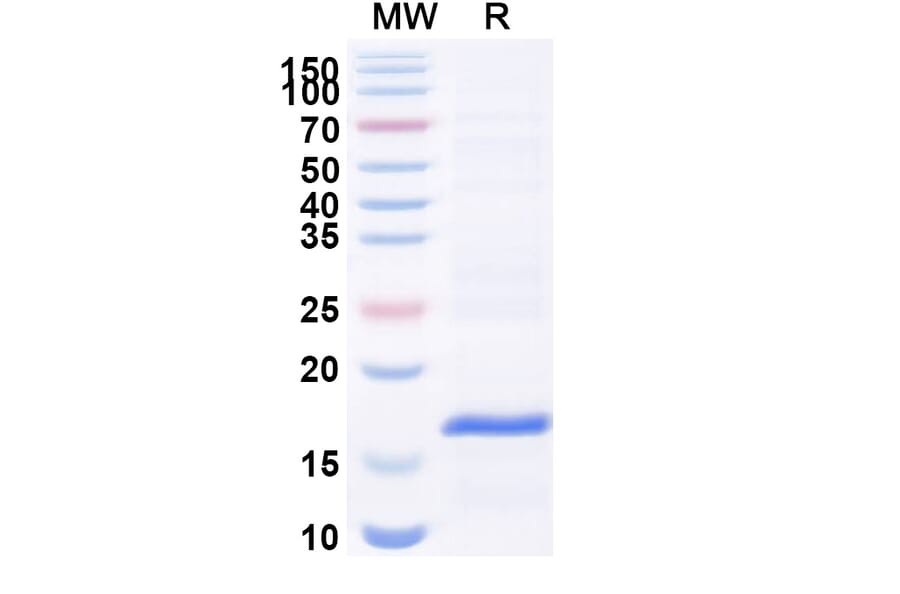 SDS-PAGE - Anti-VWF Nanobody [C37] (A338270) - Antibodies.com