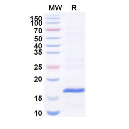 SDS-PAGE - Anti-VWF Nanobody [C37] (A338270) - Antibodies.com
