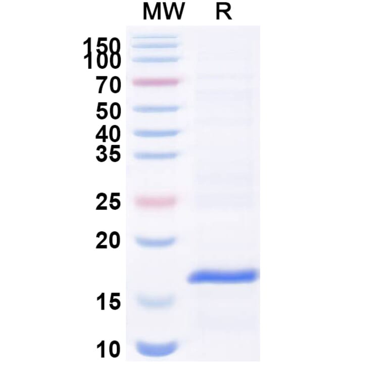 SDS-PAGE - Anti-VWF Nanobody [C37] (A338270) - Antibodies.com