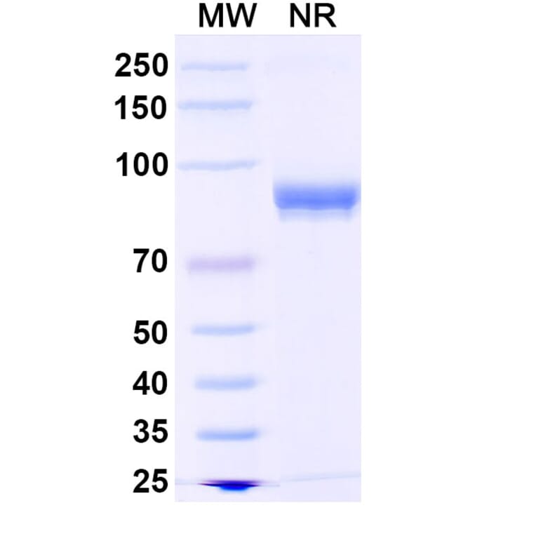 SDS-PAGE - Anti-MMP13 Nanobody [40E09#] (A338271) - Antibodies.com