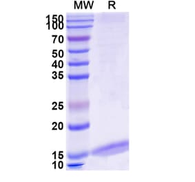 SDS-PAGE - Anti-Albumin Nanobody [MSA21] (A338272) - Antibodies.com