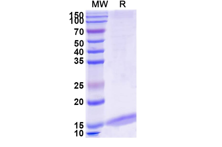 SDS-PAGE - Anti-Albumin Nanobody [MSA21] (A338272) - Antibodies.com