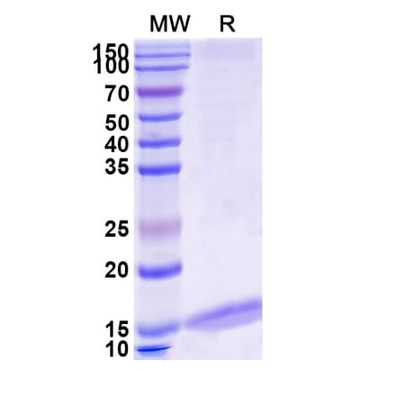 SDS-PAGE - Anti-Albumin Nanobody [MSA21] (A338272) - Antibodies.com