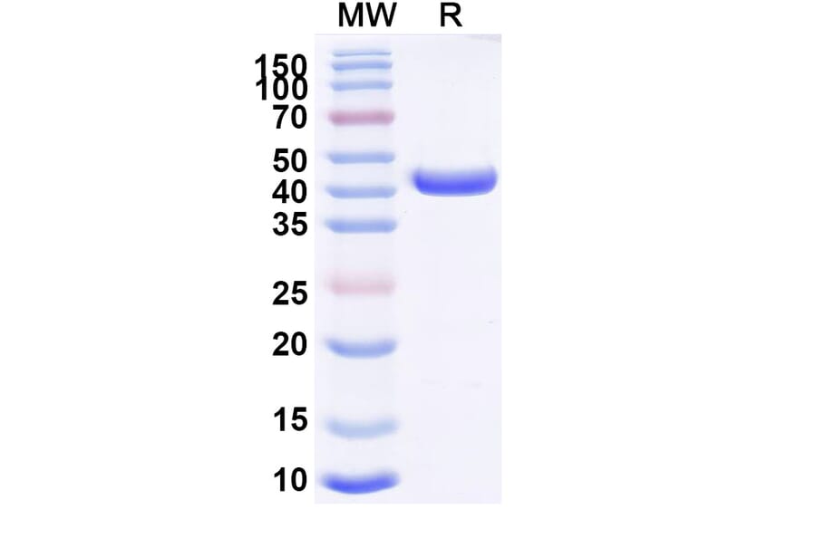 SDS-PAGE - Anti-CD163 Nanobody [2G01] (A338273) - Antibodies.com