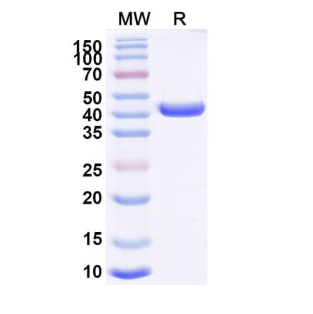 SDS-PAGE - Anti-CD163 Nanobody [2G01] (A338273) - Antibodies.com