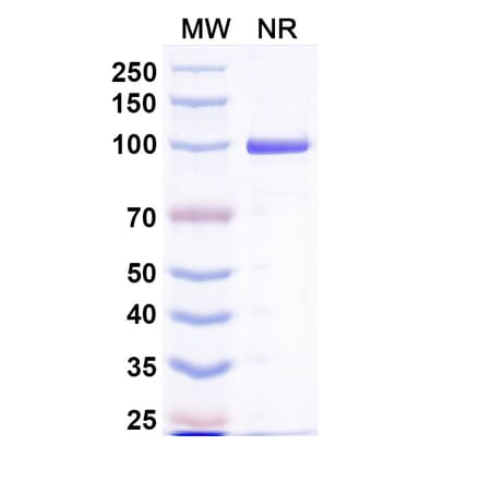 SDS-PAGE - Anti-Capsid Protein Nanobody [Nano-4] (A338274) - Antibodies.com