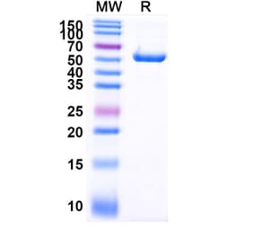SDS-PAGE - Anti-PLAC1 Nanobody [SAA2073] (A338278) - Antibodies.com