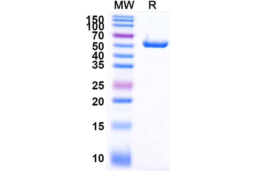 SDS-PAGE - Anti-PLAC1 Nanobody [SAA2073] (A338278) - Antibodies.com