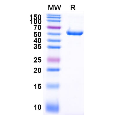 SDS-PAGE - Anti-PLAC1 Nanobody [SAA2073] (A338278) - Antibodies.com