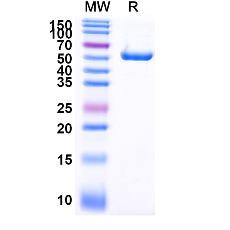 SDS-PAGE - Anti-PLAC1 Nanobody [SAA2073] (A338278) - Antibodies.com