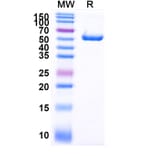 SDS-PAGE - Anti-PLAC1 Nanobody [SAA2073] (A338278) - Antibodies.com