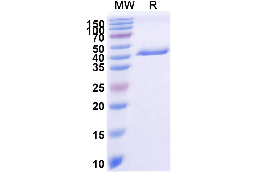 SDS-PAGE - Anti-PLAC1 Nanobody [SAA2073] (A338278) - Antibodies.com